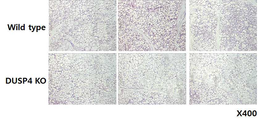 DUSP4 KO mice에서의 Inguinal adipose tissue 내 형태적 변화관찰