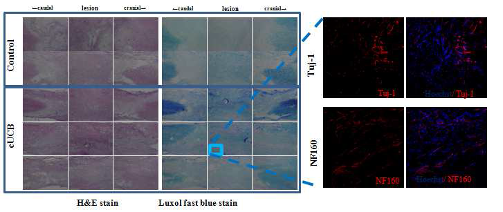 H&E stain, Luxol fast blue stain과 세포주입군에서 Tuj-1, NF160 발현