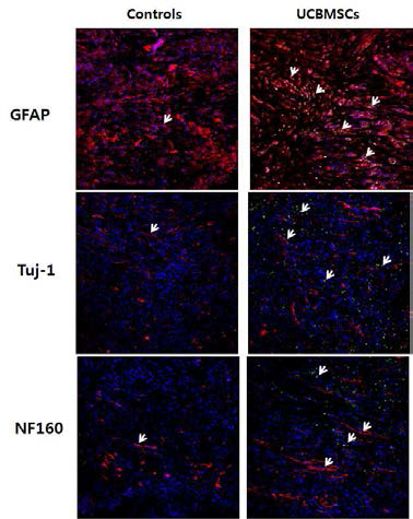 척수 손상부에서 GFAP, Tuj-1, NF160 면역염색