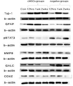 손상 척수의 Tuj-1, GFAP, pSTAT3, MMP9, GALC, COX2 단백질 발현