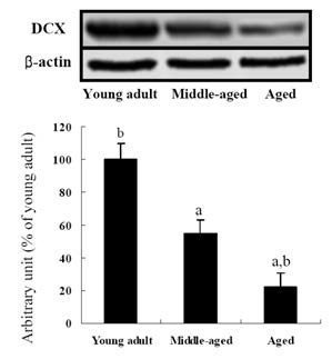 후각망울의 DCX 단백질의 발현이 연령과 비례하여 현저하게 감소함.