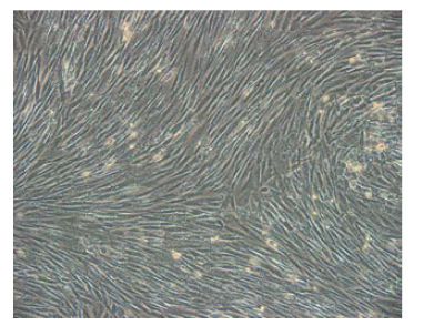 Human mammary adipose-derived mesenchymal stem cell