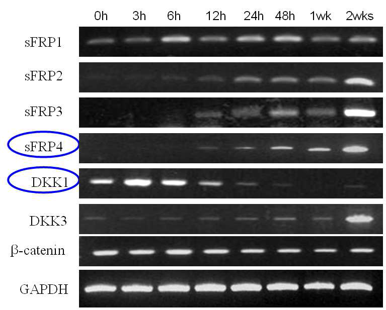 Relevance of Wnt antagonist in human adipogenesis