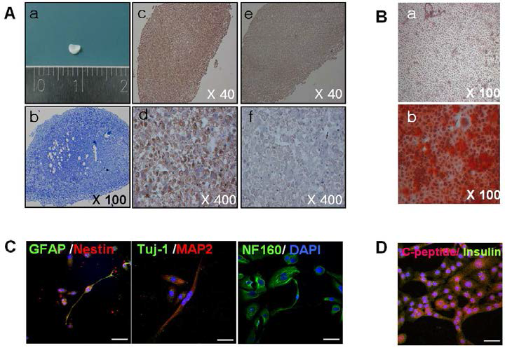 Chondrogenic (A), osteogenic (B), neurogenic (C) and Beta-cell differentiation (D) of amniotic epithelial cells.