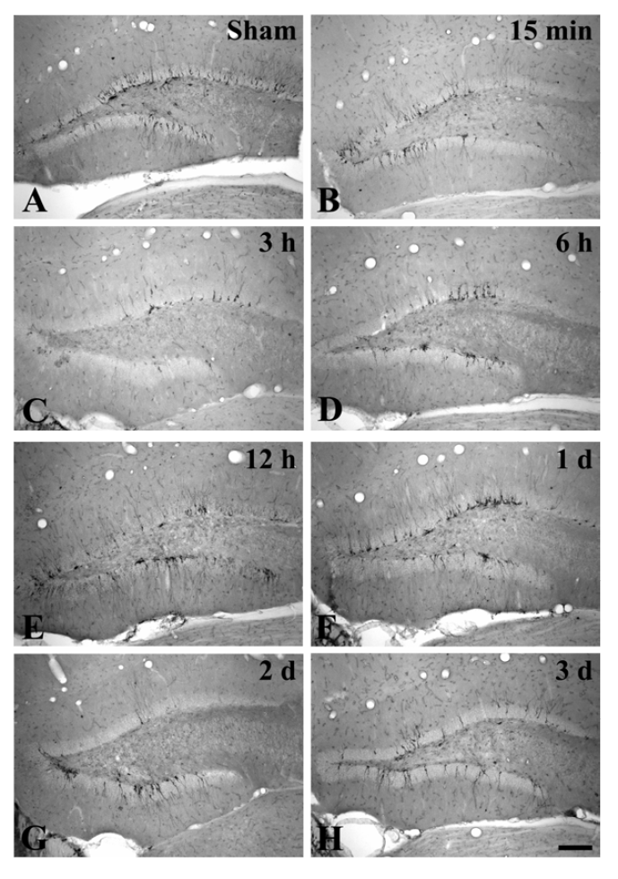Photomicrograph of DCX immunoreactivity in the dentate gyrus in sham-operated (A) and operated (B-H) groups.