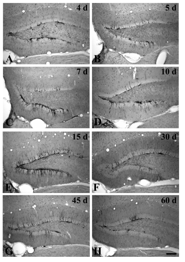 Photomicrograph of DCX immunoreactivity in the dentate gyrus in operated (A-H) groups.