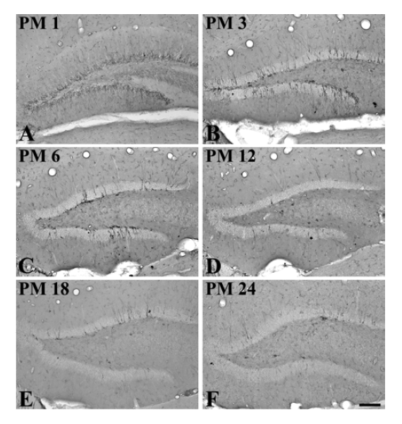 Low magnification of doublecortin (DCX) immunoreactivity in the gerbil dentate gyrus at postnatal month (PM) 1 (A), 3 (B), 6 (C), 12 (D), 18 (E) and 24 group (F).