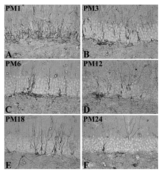 High magnification of DCX immunoreactivity in the upper blade of the dentate gyrus at postnatal month (PM) 1 (A), 3 (B), 6 (C), 12 (D), 18 (E) and 24 group (F).