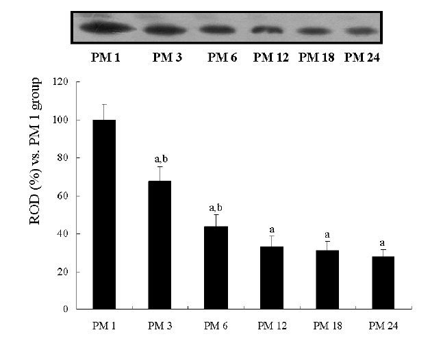 Western blot analysis of DCX in the dentate gyrus derived from various aged gerbils.