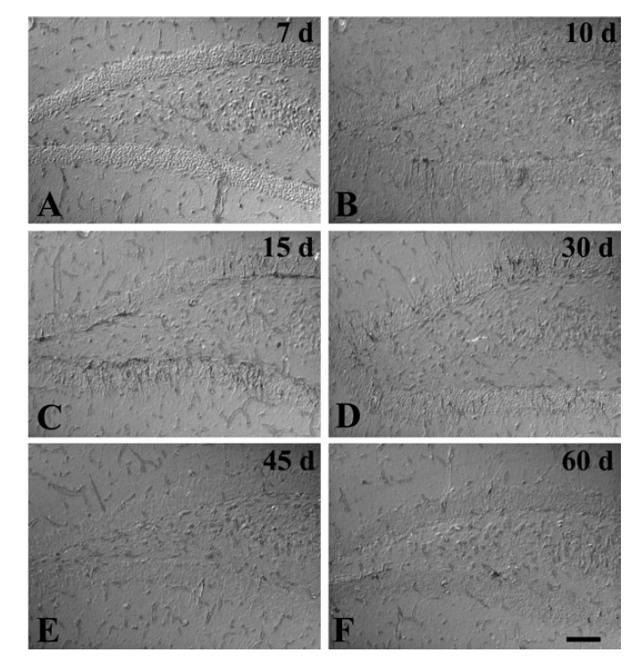 Photomicrograph of DCX immunoreactivity in the dentate gyrus in sham-operated (A) and operated (B-F) groups.