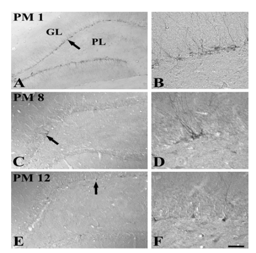 Microphotographs of DCX immunoreactivity in the dentate gyrus in the SDR at PM 1 (A and B), PM 8 (C and D) and PM 12 (E and F).