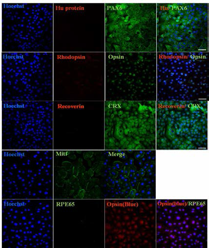 미분화상태에서 양막유래 상피줄기세포의 retinal specific marker발현