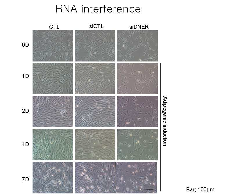 DNER siRNA에 의한 knock-down과 지방분화에 따른 세포형태의 변화