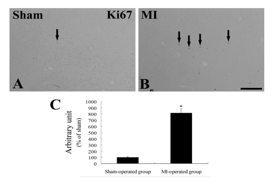 Immunohistochemistry for Ki67 in the amygdala of sham- (A) and MI-operated (B) groups 14 days after MI induction.