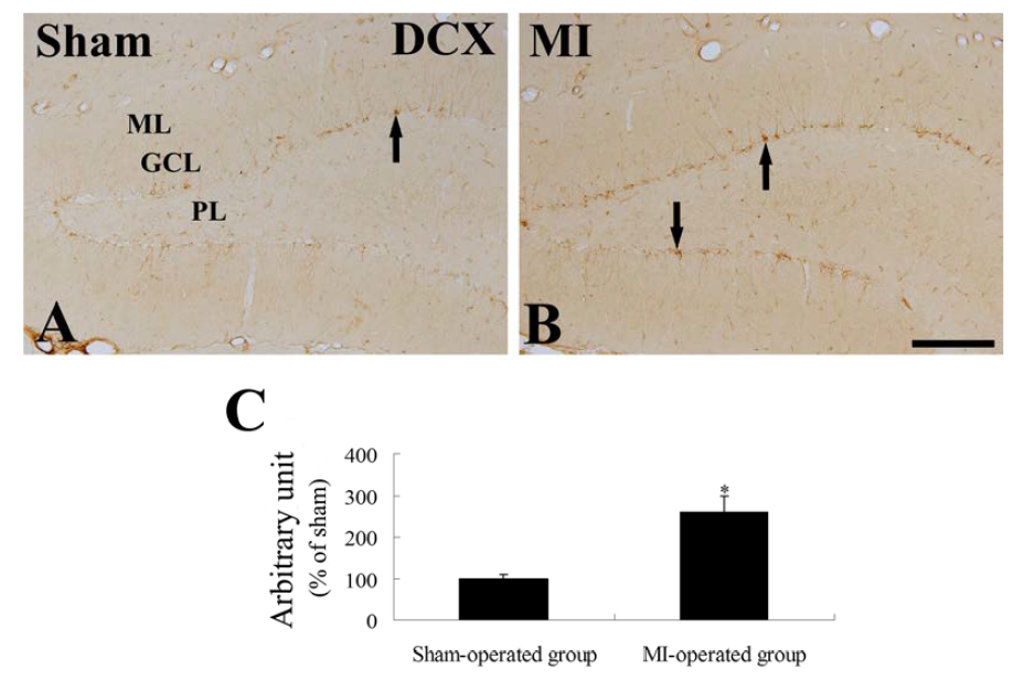 Immunohistochemistry for DCX in the DG of the sham- (A) and MI-operated (B) groups 14 days after MI induction.