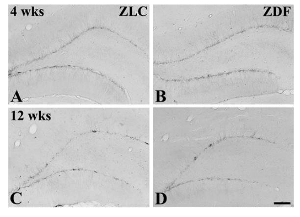 Low magnification of doublecortin (DCX) immunoreactivity in the dentate gyrus in ZLC (A and C) and ZDF (B and D) rats at 4 (A and B) and 12 weeks (C and D) of age.