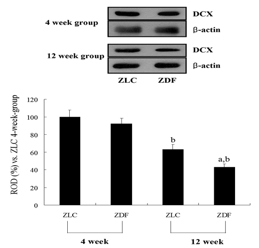 Western blot analysis of DCX in the dentate gyrus of ZLC and ZDF rats.