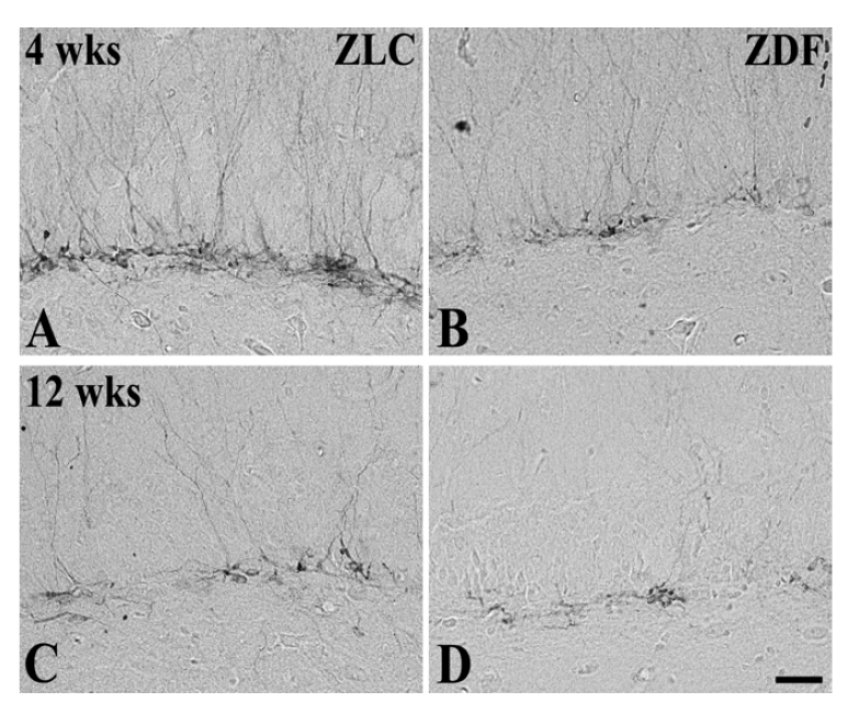High magnification of DCX immunoreactivity in the lower blade of the dentate gyrus in ZLC (A and C) and ZDF (B and D) rats at 4 (A and B) and 12 weeks (C and D) of age.