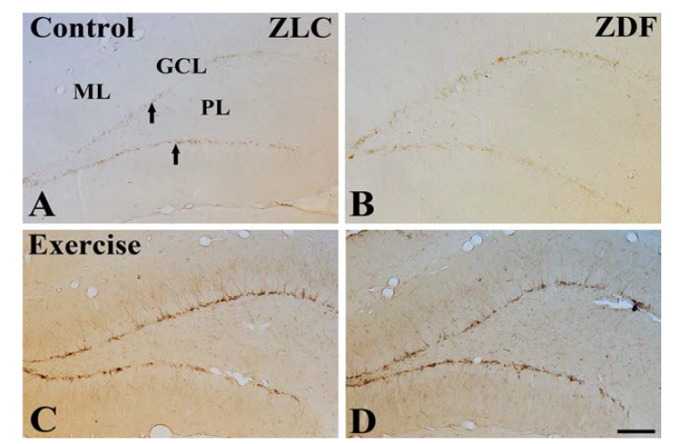 Low magnification of DCX-immunoreactive cells in the dentate gyrus in groups at 12 weeks of age.