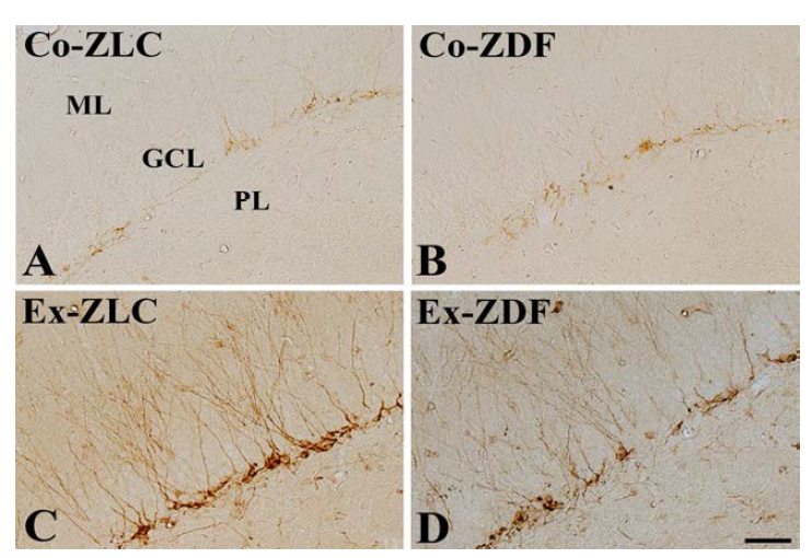 High magnification of DCX-immunoreactive cells in the upper blade of the dentate gyrus in control-ZLC (Co-ZLC), control-ZDF (Co-ZDF), exercise-ZLC (Ex-ZLC) and exercise-ZDF (Ex-ZDF) at 12 weeks of age.