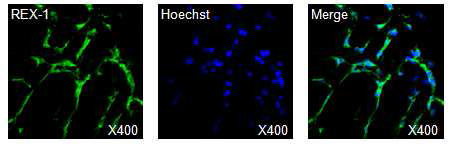 REX-1 면역염색 실험 결과.