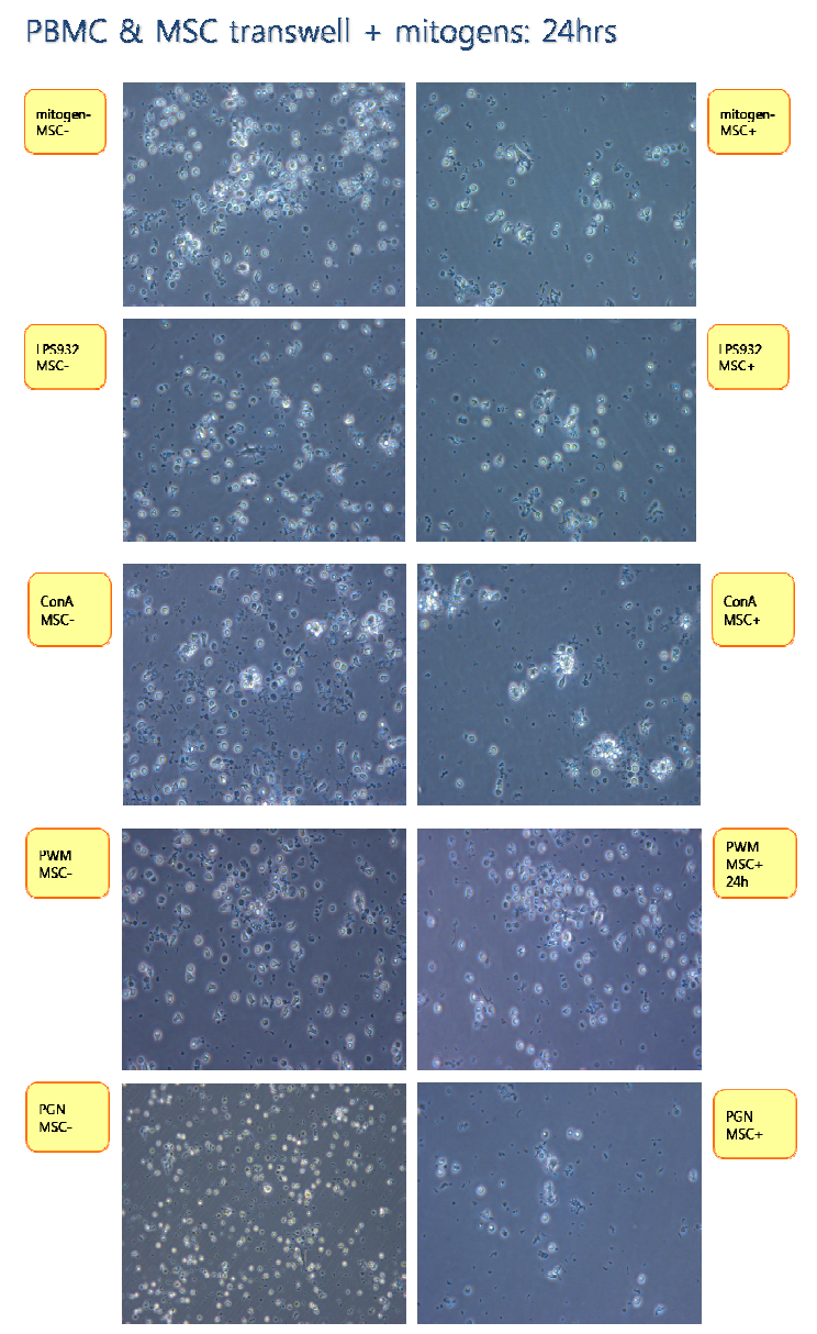 중간엽 줄기세포를 PBMC (peripheral blood mononuclear cell)와 공배양시 mitogen 자극에도 PBMC 의 분화 및 증식이 오히려 감소