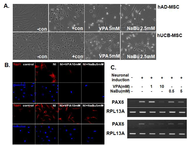 HDAC inhibitor에 의한 지방 및 제대혈 중간엽 줄기세포의 신경분화조절