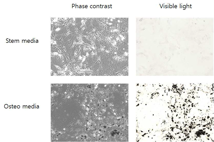 줄기세포 배양 조건과 조골 분화 조건에서 14일 간 배양한 세포를 von Kossa staining을 통해 분석함