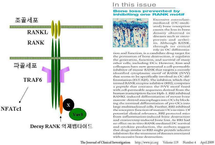 조골-파골세포 상호작용 시, RANK-RANKL의 결합 및 파골세포 분화 유도.