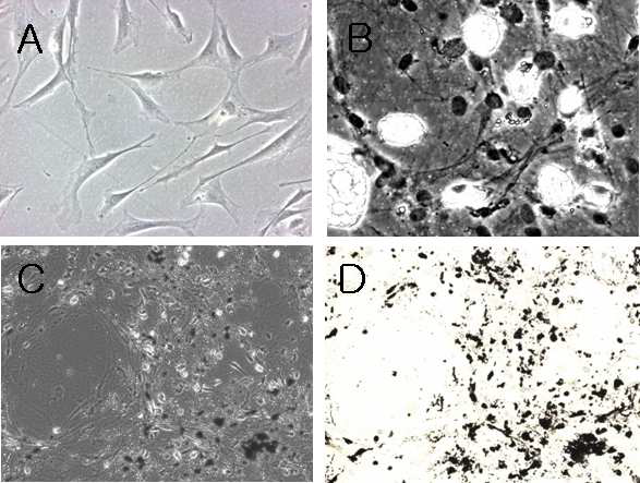 (A) 지방간엽줄기세포. (B) 지방세포 lipid droplet이 있는 세포가 보 임. (C) 조골 세포의 phase contrast 사진. (D) 같은 visual field를 bright field에서 본것; von Kossa plaque가 다수 보임.