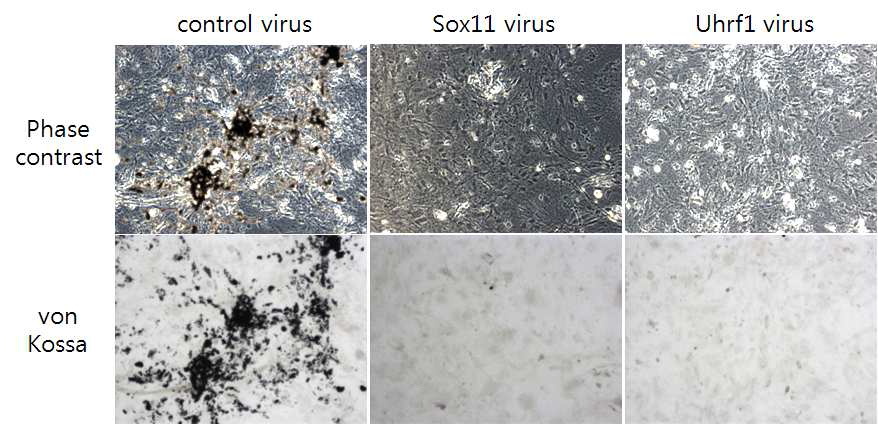 Retrovirus를 이용한 Sox11과 Uhrf1이 과발현 된 상황에서는 control과 달리 von Kossa staining이 보이지 않음.