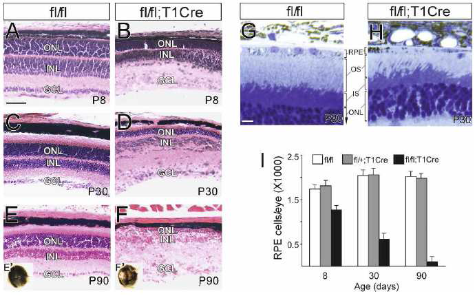 망막색소상피세포 특이적 Pten 결핍 생쥐의 망막퇴행.
