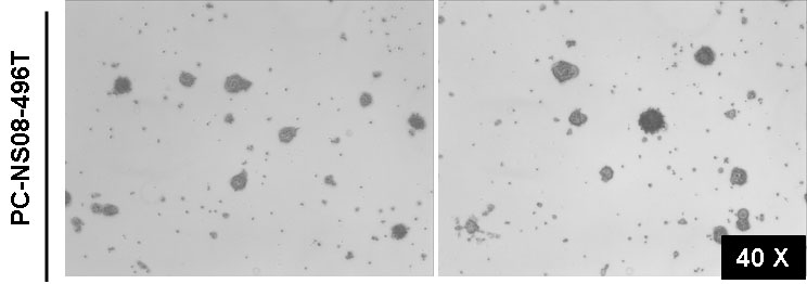 인간 교모세포종 유래 신경구 (PC-NS08-496T)를 세절배양기로 배양한 결과