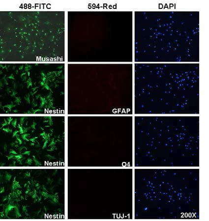 PC-NS08-526 측두엽 유래 일차배양 세포 (계대 7)에서의 신경줄기세포 마커 단백질 발현양상