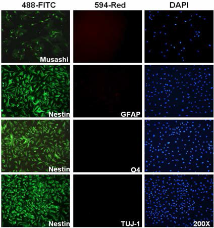 pLenti7.3;PUbC/NICD-PPGK/Puro 세포주를 대상으로 한 신경줄기세포 마커 단백질의 발현양상