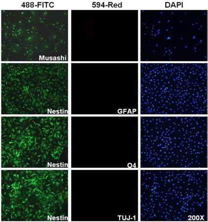 pLenti7.3;PUbC/c-MET-PPGK/Puro 세포주를 대상으로 한 신경줄기세포 마커 단백질의 발현양상