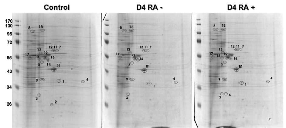 Retinoic acid를 처리하여 분화를 유도한 H9 세포에서 차별 발현되는 단백질 spot 들을 선정한 결과. 분화개시 4일 후에 각각 retinoic acid를 처리하지 않은 군 (D4 RA-)과 처리한 군 (D4 RA+) 사이를 비교하였다