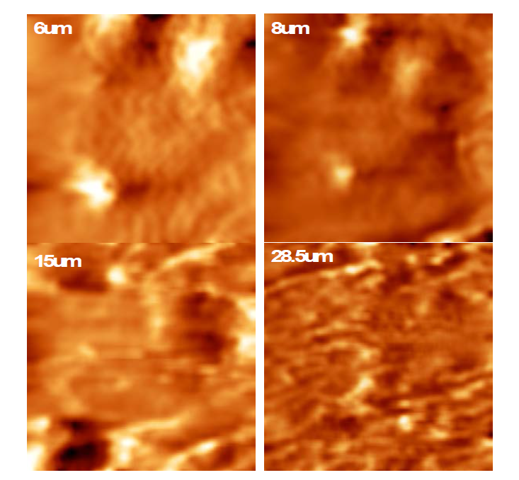High-speed SICM images of collagen