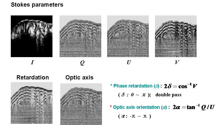 스톡스 알고리듬으로부터 획득된 쥐 꼬리근의 스톡 스 변수 I, Q, U, V 이미지와 4개의 스톡스 이미지로부터 재구성된 복굴절(retardation) 및 광 축(optic axis) 이미 지