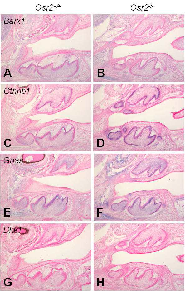 Alterations of gene expression in the developing tooth of Osr2 null mouse at neonate; sagittal section