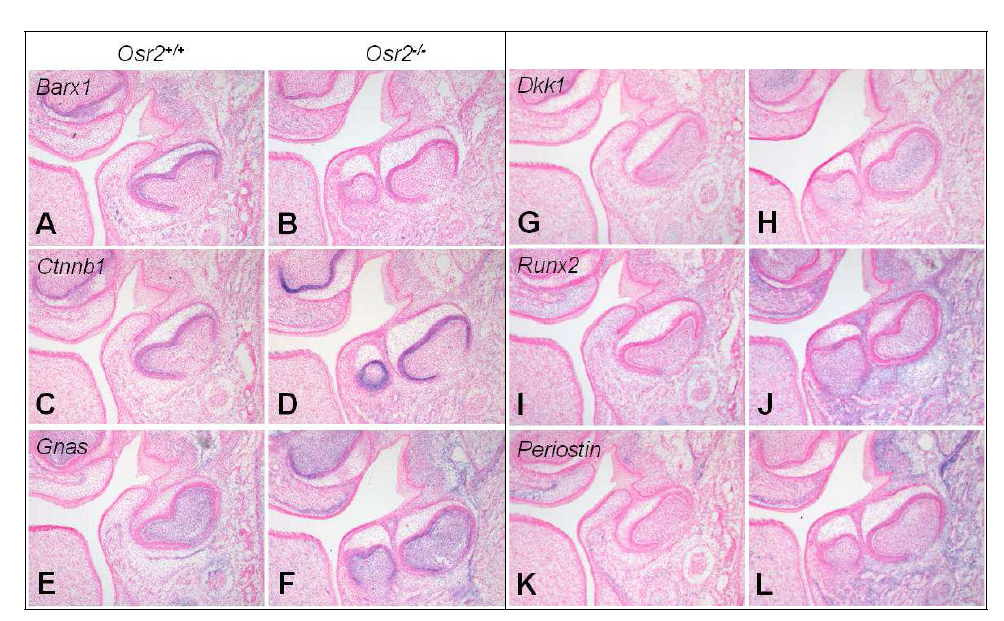 Alterations of gene expression in the developing tooth of Osr2 null mouse at neonate; frontal section