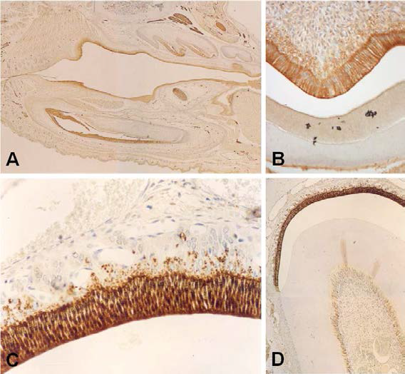 Localization of Ubiquitin carboxyl-terminal hydrolase in the dental epithelium during mouse tooth development