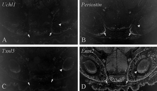 Expression of Ubiquitin carboxyl-terminal hydrolase in the dental epithelium during mouse tooth development