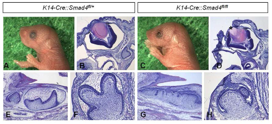 Epithelial tissue-specific Smad4 inactivation with K14-Cre transactivator causes the impaired development of eyelids, whiskers and tooth