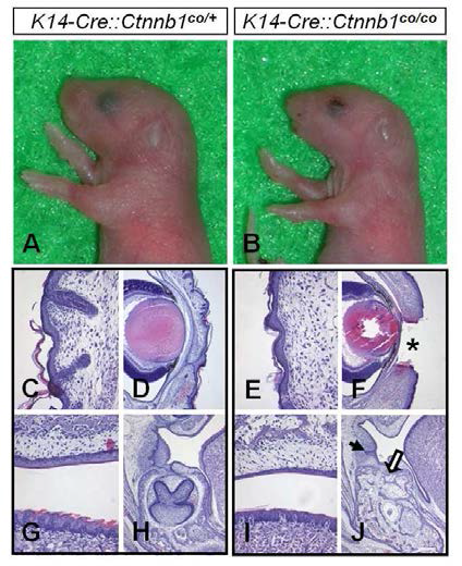 Epithelial tissue-specific β-Catenin inactivation with K14-Cre transactivator causes the impaired development of ectodermal organs, eyelids, hair, tongue papillae, and tooth