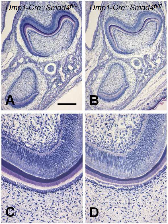 Delayed tooth development in the Dmp1-Cre mediated Smad4 conditional knockout mouse