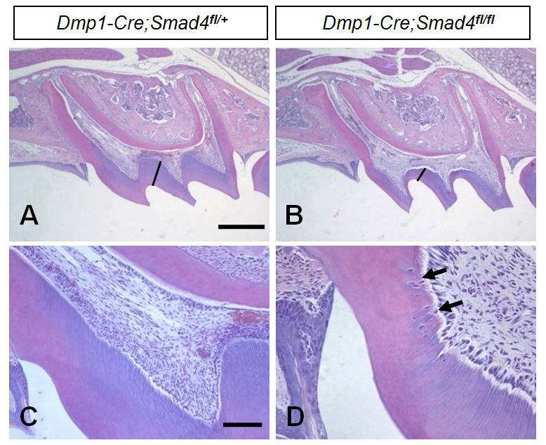 Histological features of Dmp1-Cre mediated inactivation of Smad4 during dentin formation. Coronal dentin of mutant mouse is thinner than that of wild type (A, B). In the mutant, some odontoblasts are surrounded by dentin matrix near cervical regions (arrows) (C, D)