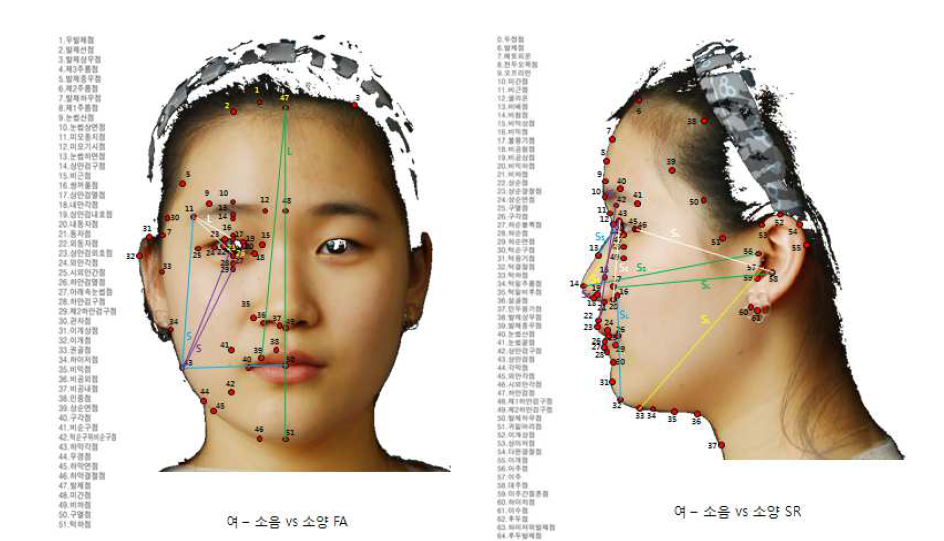 여자 소양인 vs 여자 소음인의 안면특징 비교 예시