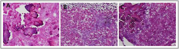 탈회상아질(A), 골수줄기세포 단독(B), 탈회생아질과 골수줄기세포 복합 체(C)의 조직학적인 비교