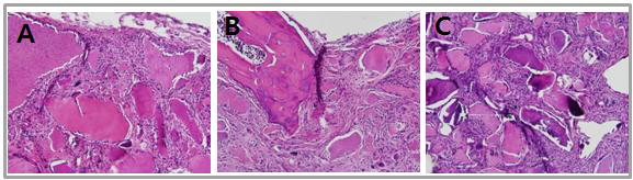 탈회상아질 단독과 RAD, RGD 표면개질된 조직들의 8주된 H&E stain. A:DDP, B:RAD-DDP, C: RGD-DDP